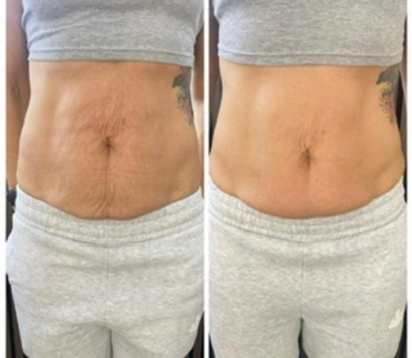 Before and after treatment result