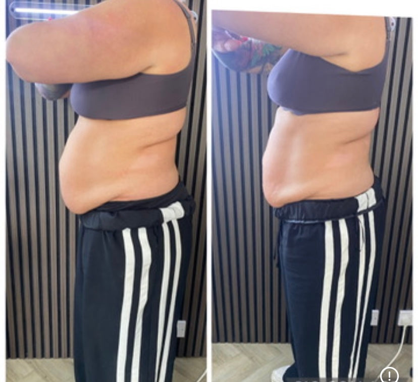 Before and after treatment result