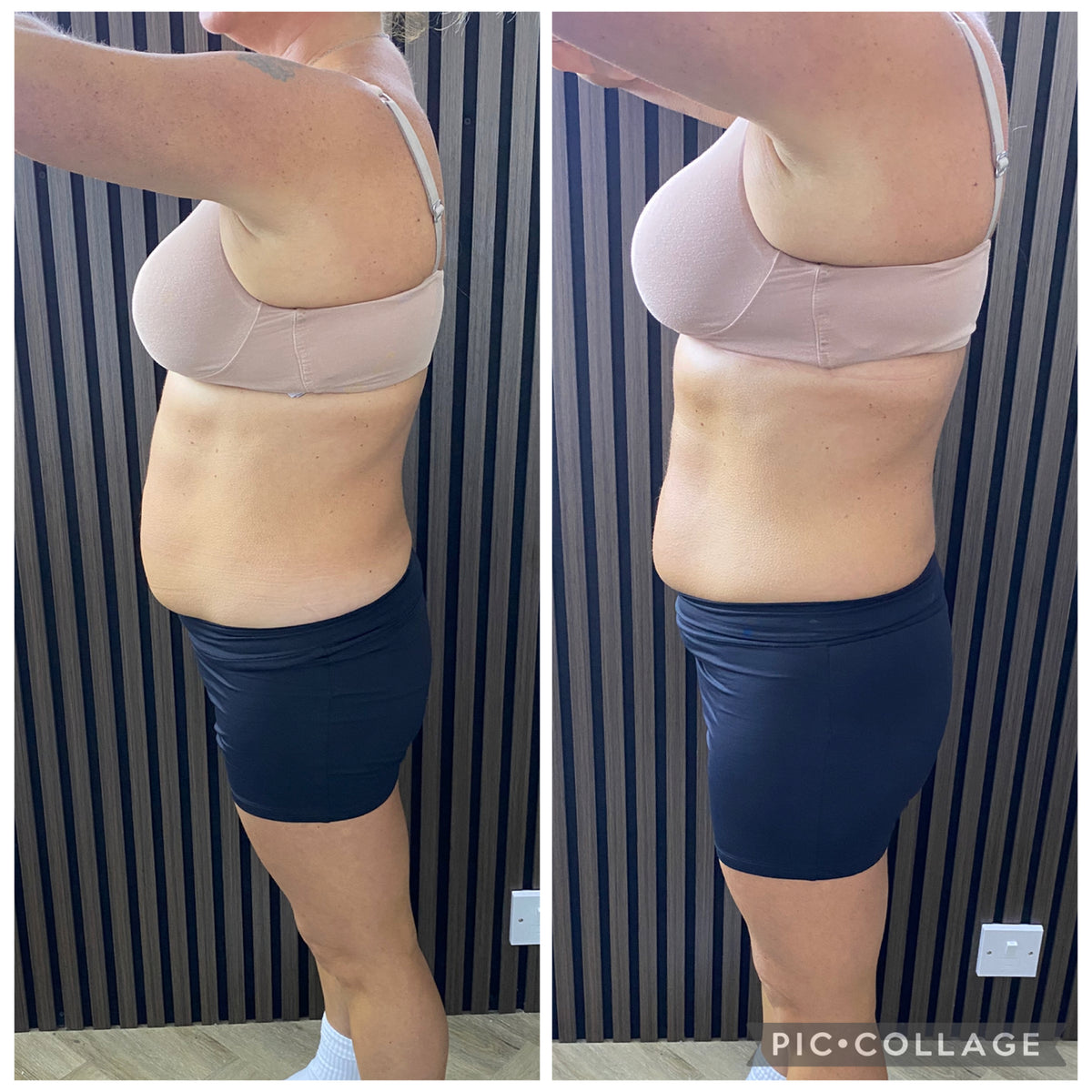 Before and after treatment result
